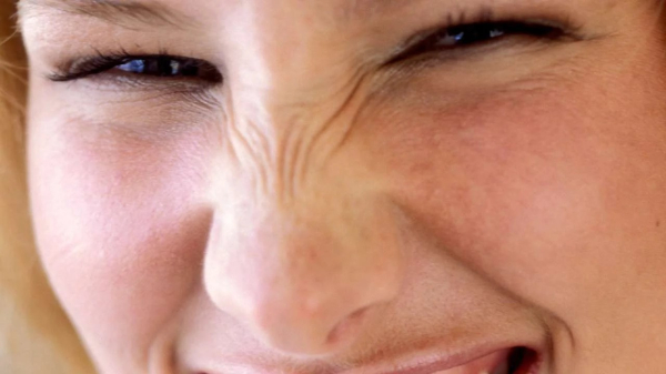 Botulotoxín / Bunny Lines - Pokrčený nos