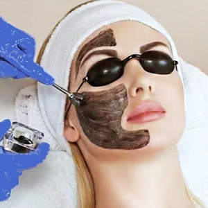 NATURAPEEL Carbon / Hollywood peeling