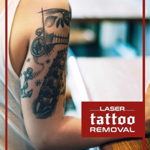 Q swith laser tetovanie/perma make up/pigmentácie